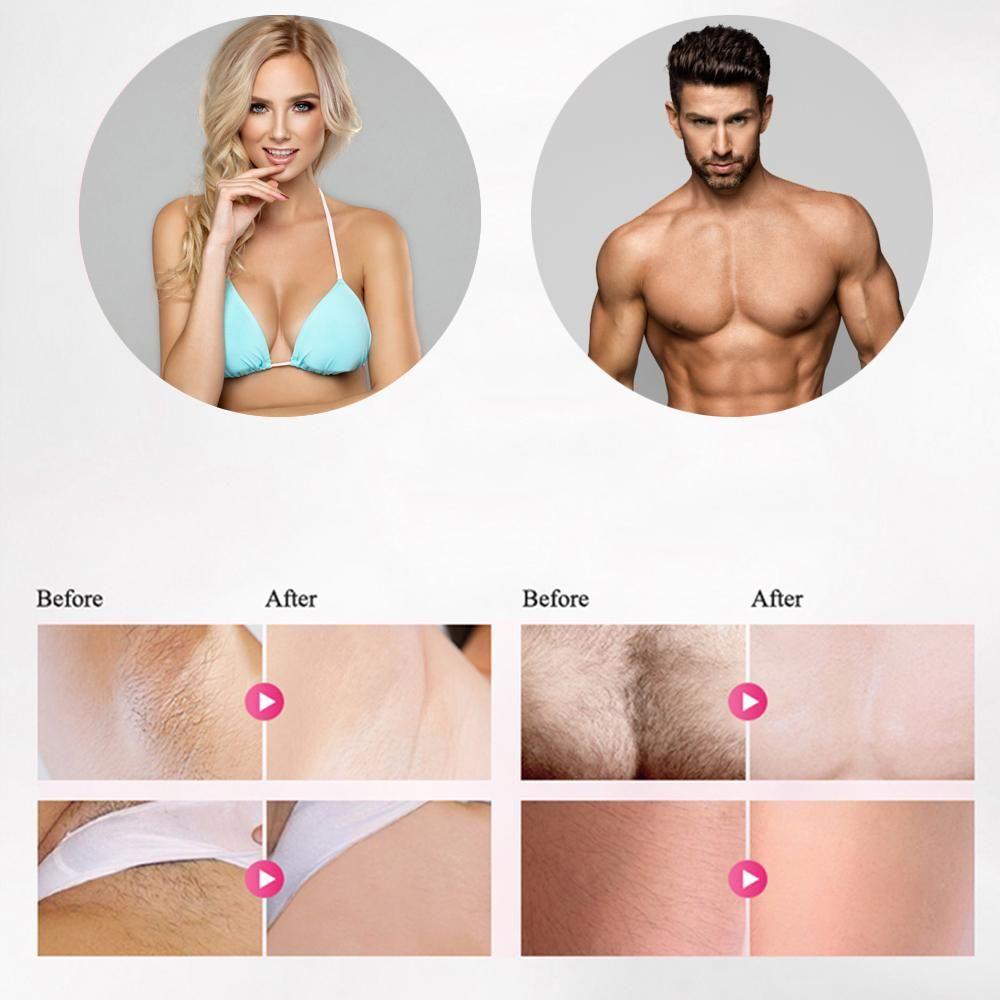 Loopstep | Professioneller IPL Epilierer Laser-Haarentfernung