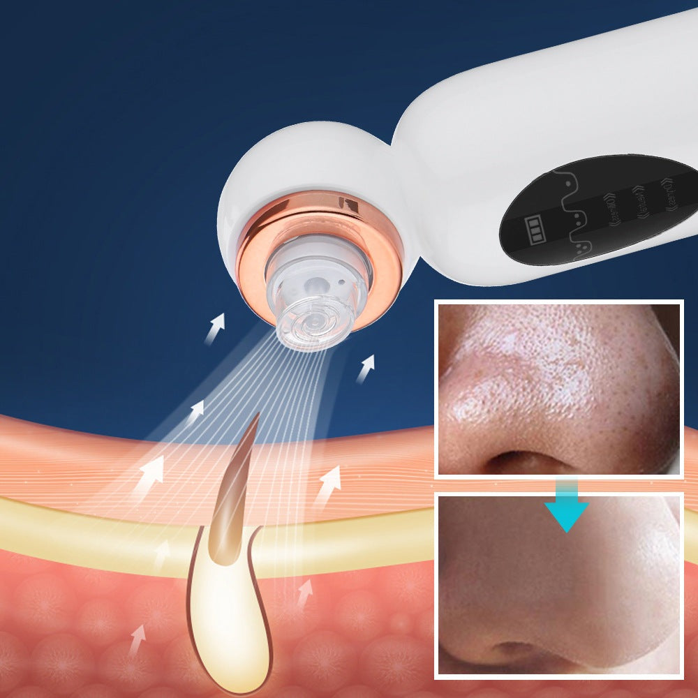 Loopstep | Hydrodermabrasion Mitesserentferner