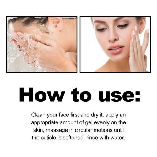 Salicylsäure Peeling-Gel, porenverfeinernd