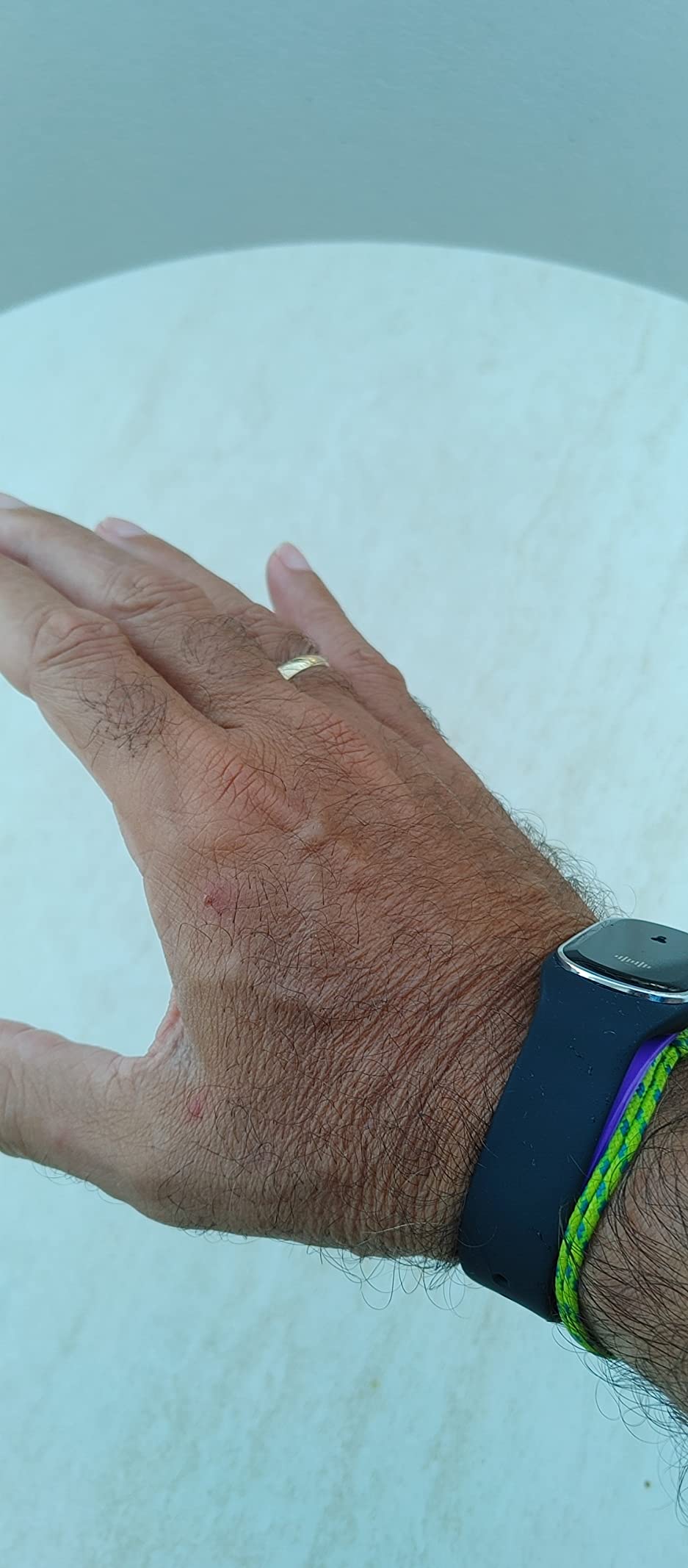 Mückenblock Armband - Smartwatch