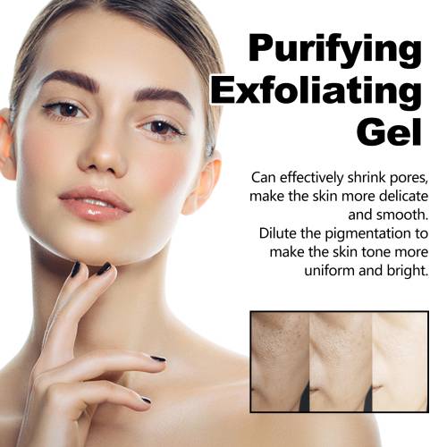 Salicylsäure Peeling-Gel, porenverfeinernd