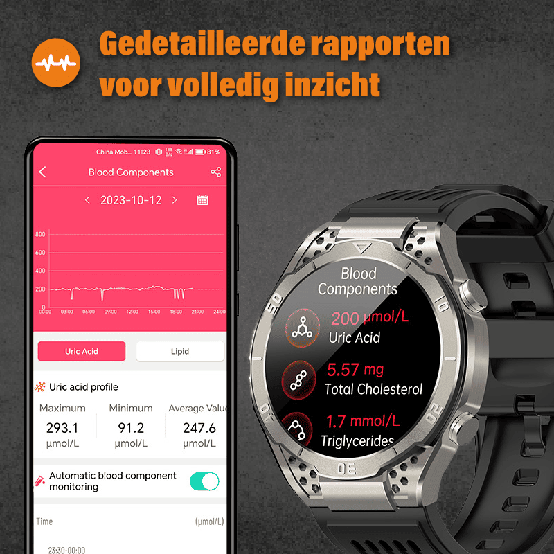 Apollo - ECG Smartwatch