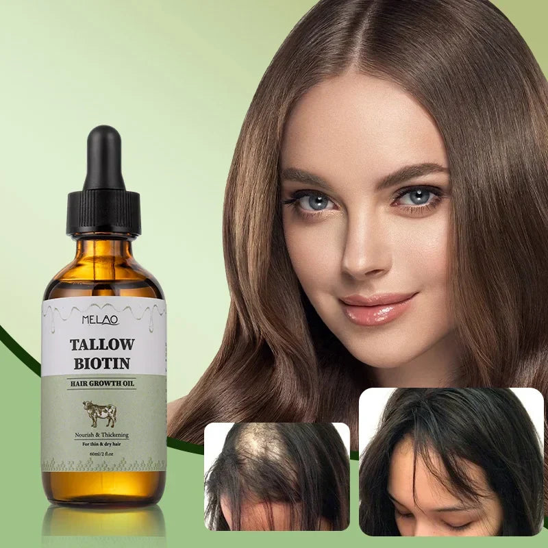 Bio-Biotin Talg Haarwachstumsöl, natürlich, kräftigend, für Männer & Frauen