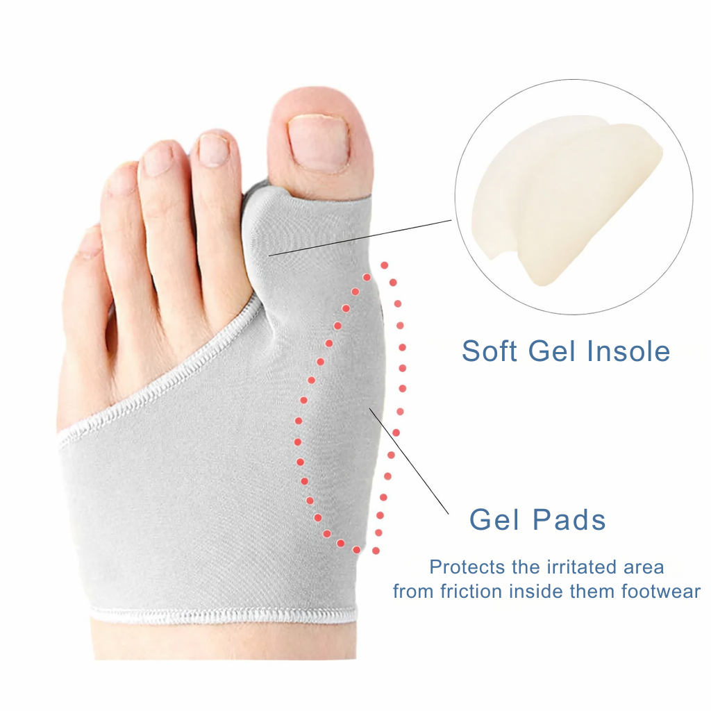 Hallux Valgus | Zehenkorrektor | Druckentlastung beim Gehen | ToeAlign