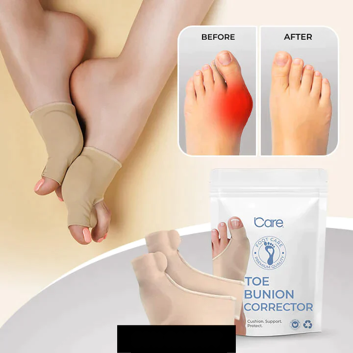 Hallux Valgus | Zehenkorrektor | Druckentlastung beim Gehen | ToeAlign