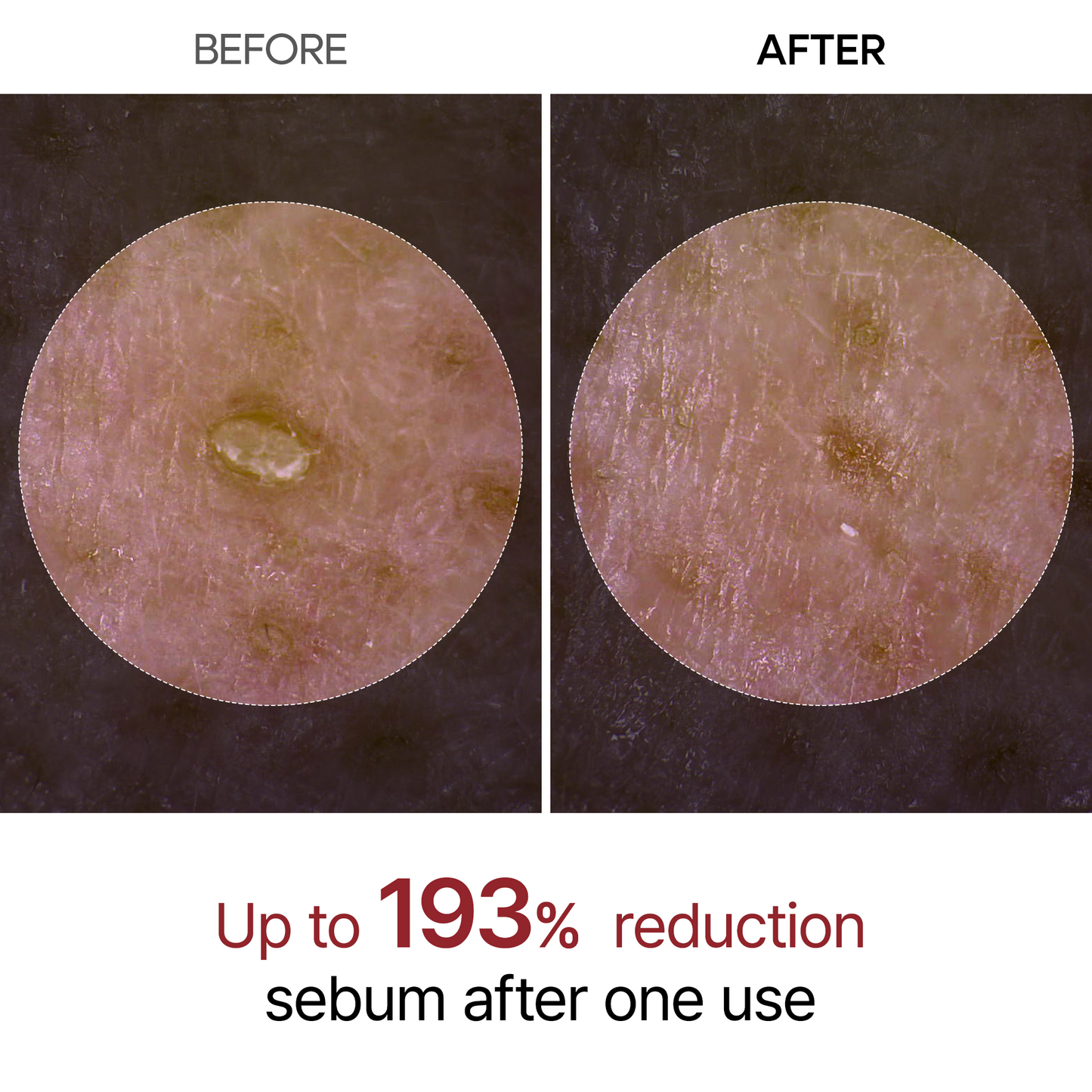 Reiswasser Peeling Ampulle, sanft, für Gesicht & Körper, empfindliche Haut