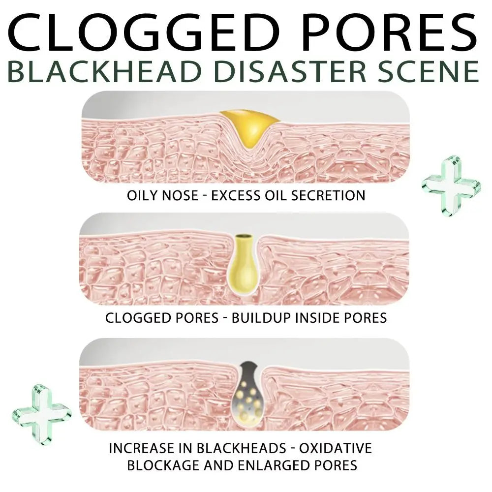 Loopstep | Schwarzer Tee Gesicht Peel-off Maske