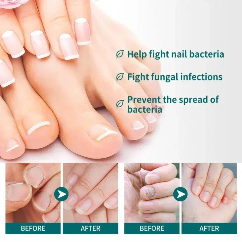 Loopstep | Nagelpilz Verteidiger Serum