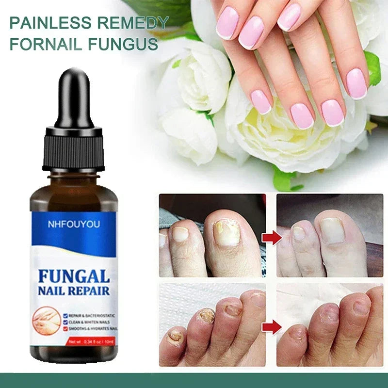Loopstep | Nagelpilz Verteidiger Serum