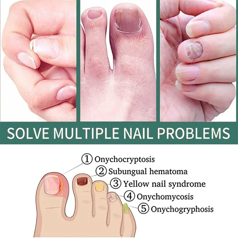 Loopstep | Nagelpilz Verteidiger Serum
