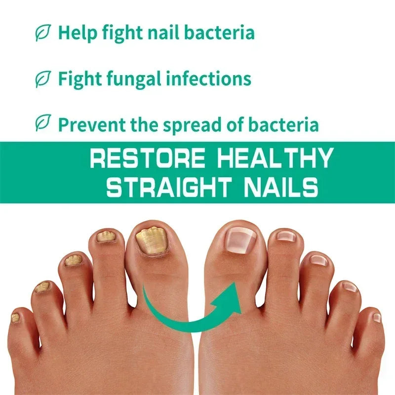 Loopstep | Nagelpilz Verteidiger Serum