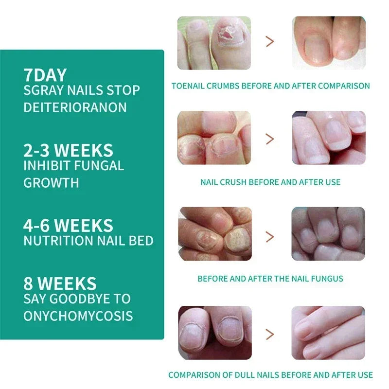Loopstep | Nagelpilz Verteidiger Serum