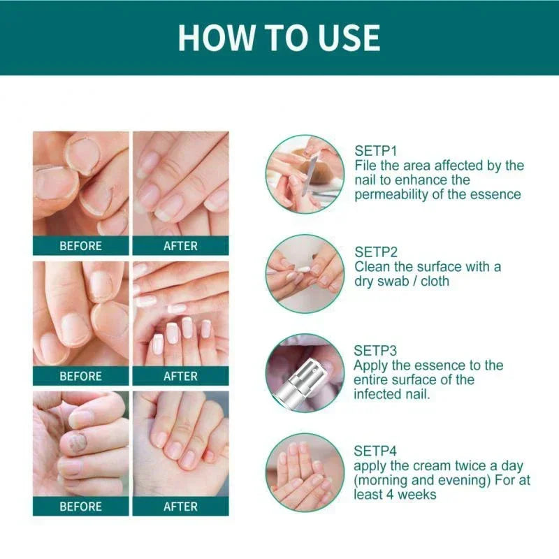 Loopstep | Nagelpilz Verteidiger Serum