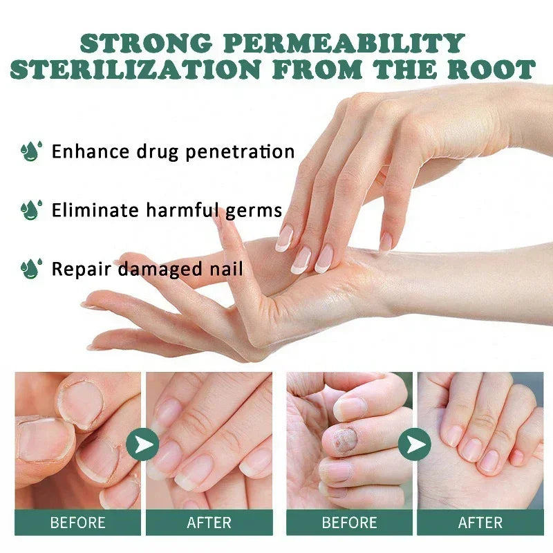 Loopstep | Nagelpilz Verteidiger Serum